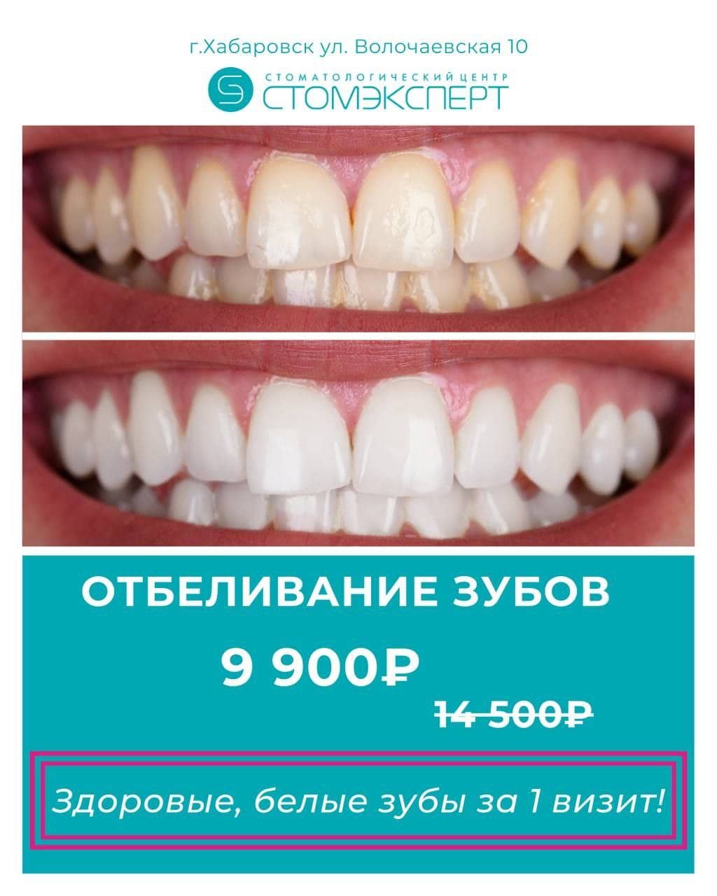 Профессиональная гигиена полости рта