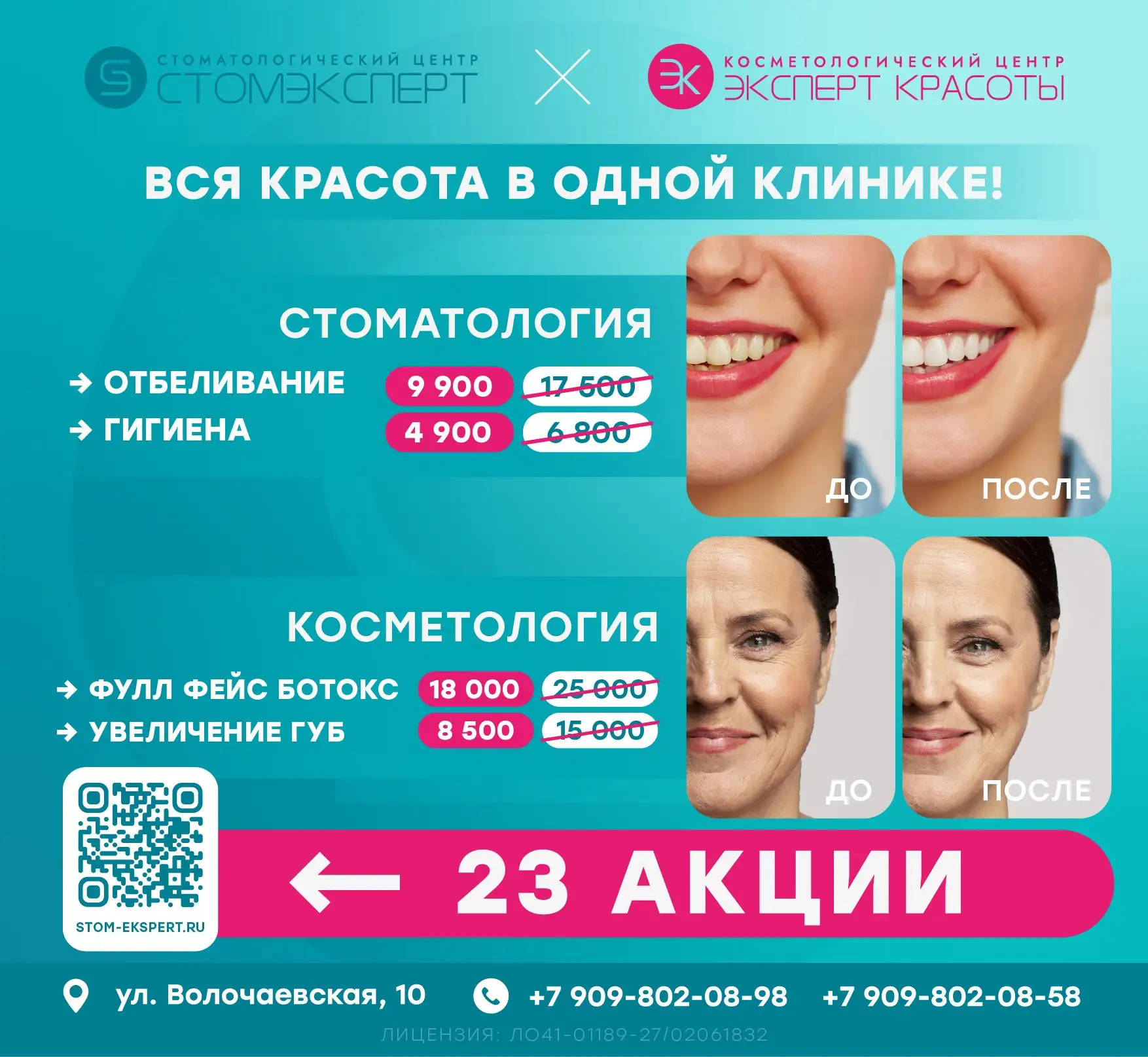 СТОМЭКСПЕРТ и ЭКСПЕРТ КРАСОТЫ: отбеливание 9 900 ₽, гигиена 4 900 ₽, Full Face Ботокс 18 000 ₽, увеличение губ 8 500 ₽